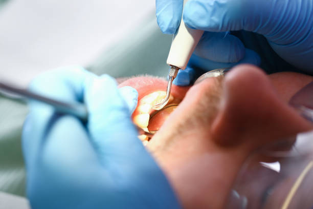 Best Urgent Dental Care for Toothaches in Crystal Falls, MI