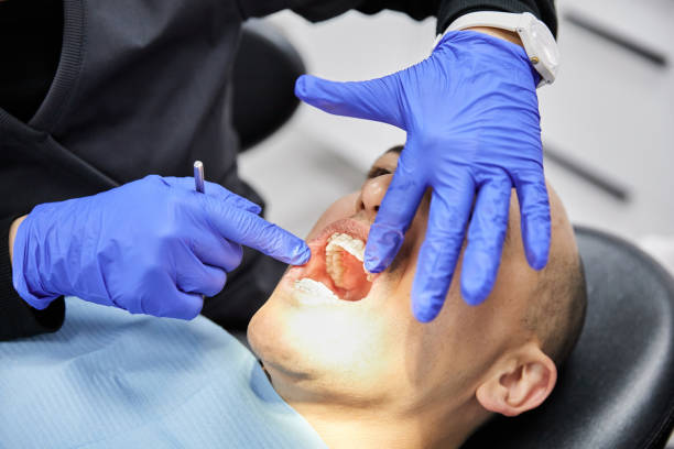 Best Emergency Root Canal Therapy in Crystal Falls, MI